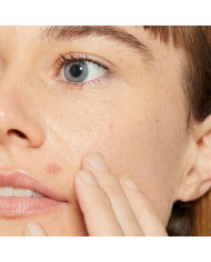 Dermalogica / Deep Breakout Liquid Patch