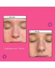 Dermalogica / Breakout Clearing Liquid Peel