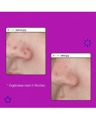 Dermalogica / Post-Breakout Fix