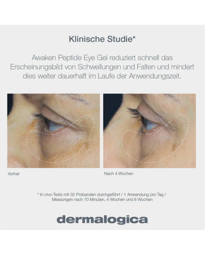 Dermalogica / Awaken Peptide Eye Gel 15ml